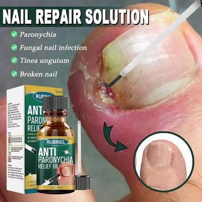 Anti Paronychia Relief Oil- Buy 1 get 1