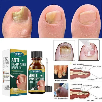 Anti Paronychia Relief Oil- Buy 1 get 1