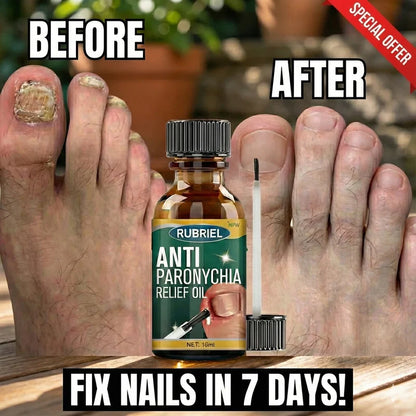 Anti Paronychia Relief Oil- Buy 1 get 1