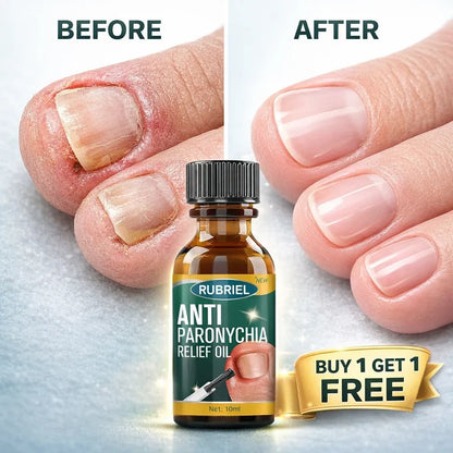 Anti Paronychia Relief Oil- Buy 1 get 1