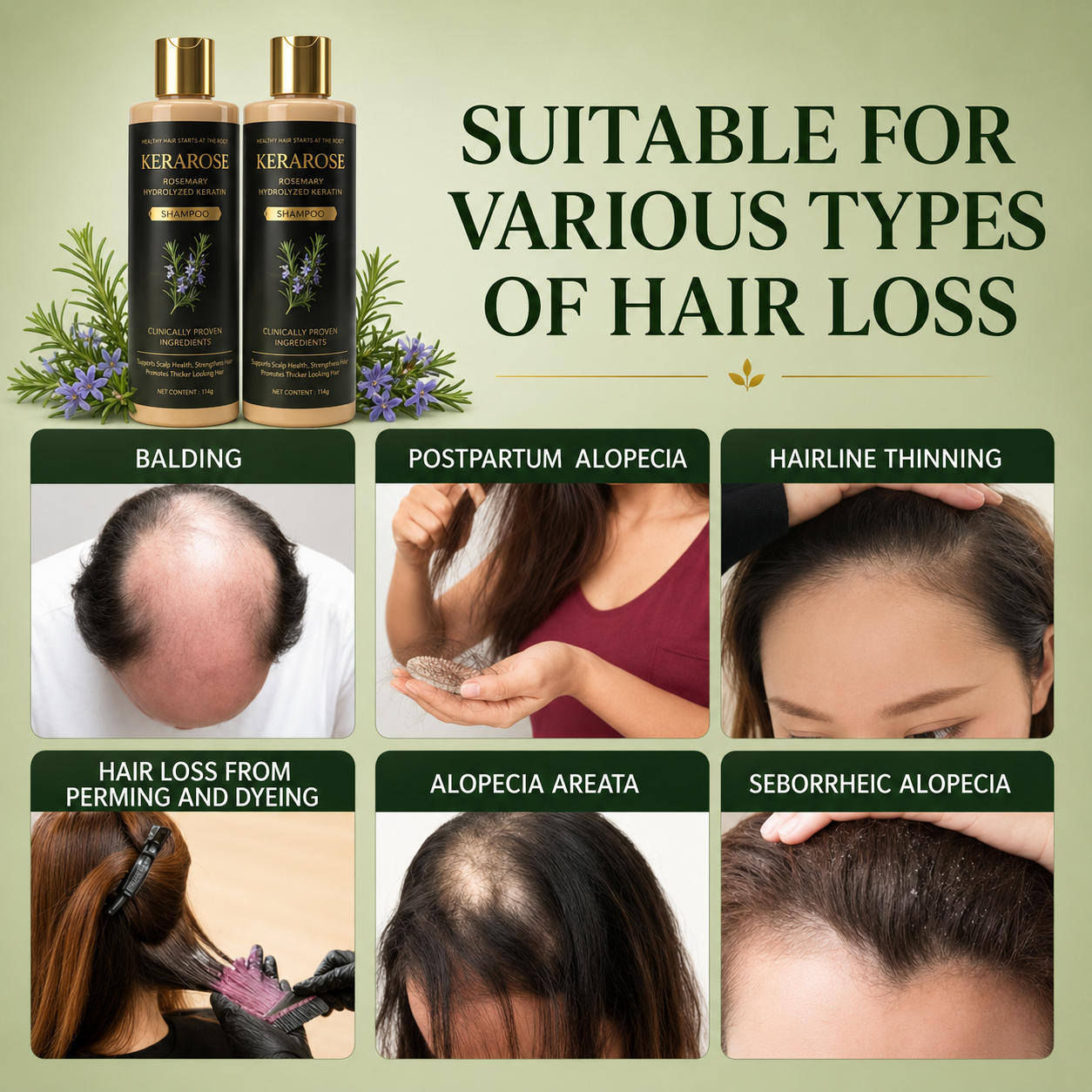 KOSBIA Kerarose Rosemary Shampoo for Hair Regrowth  - BUY 1 GET 1 Free