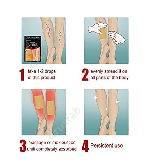 AI Varicose Veins Health Care Spray (Pack of 2)